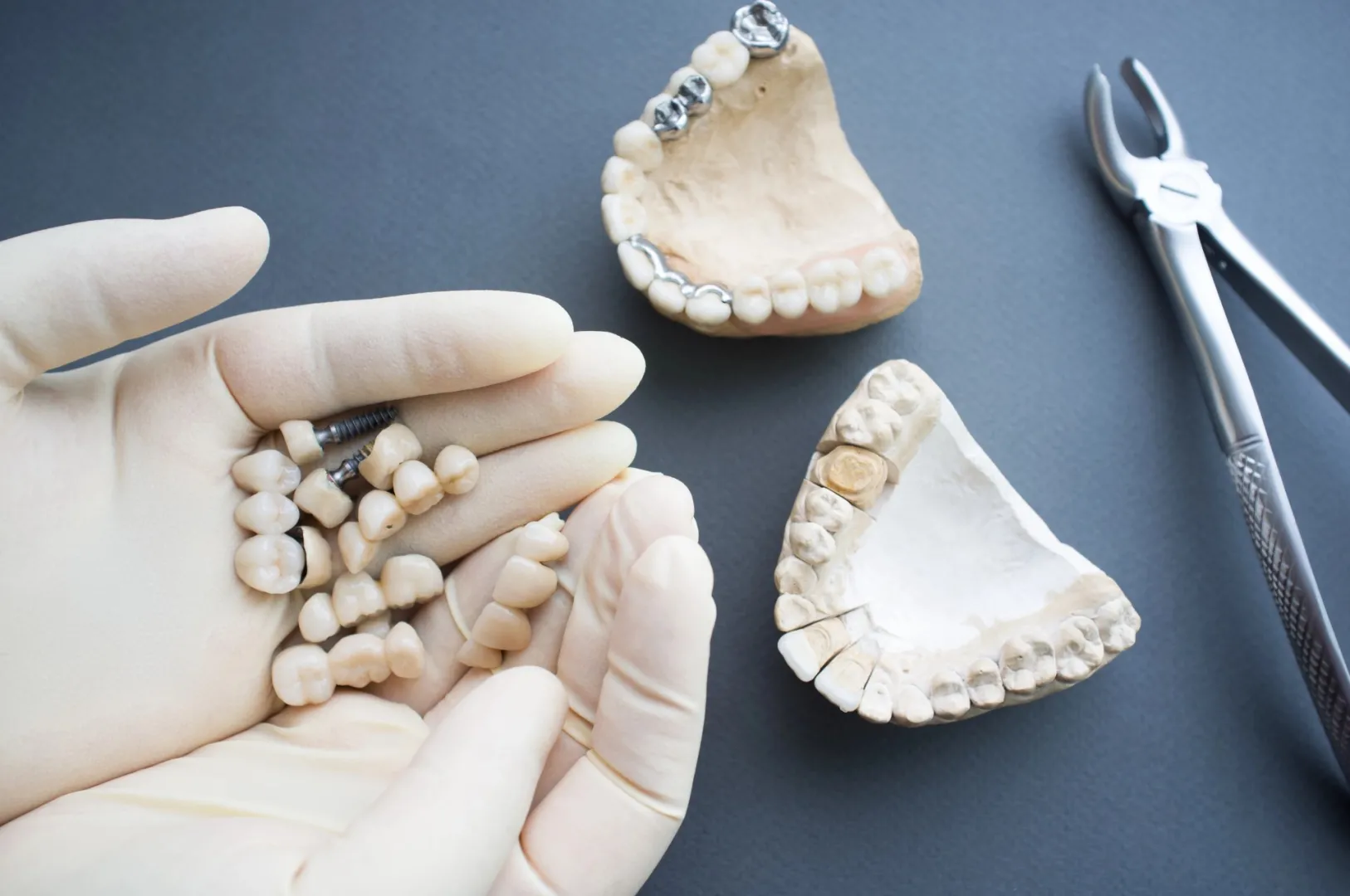 lodz-implanty-zebowe